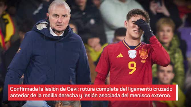 Imagen de vista previa para Gavi dice adiós a la temporada: rotura del ligamento cruzado y lesión asociada al menisco