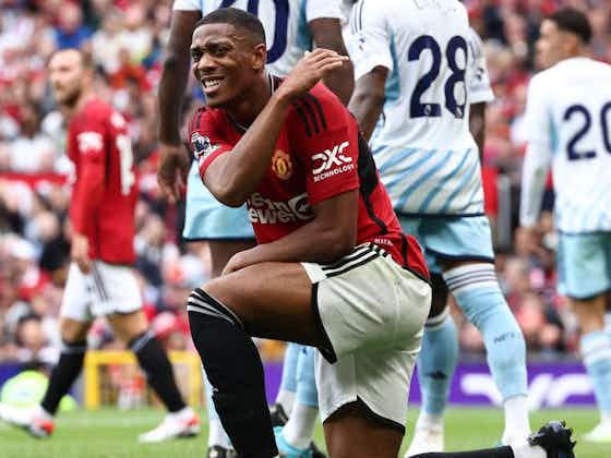 Article image:Anthony Martial to consult Man United’s medical department over possibility of hip surgery