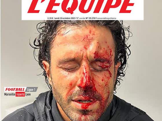 Immagine dell'articolo:📸L'Équipe: "Disgusto e vergogna", la ricostruzione della serata di Grosso