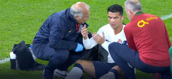Imagen del artículo:Cristiano Ronaldo sufrió un terrible golpe que le dejó el rostro cubierto de sangre