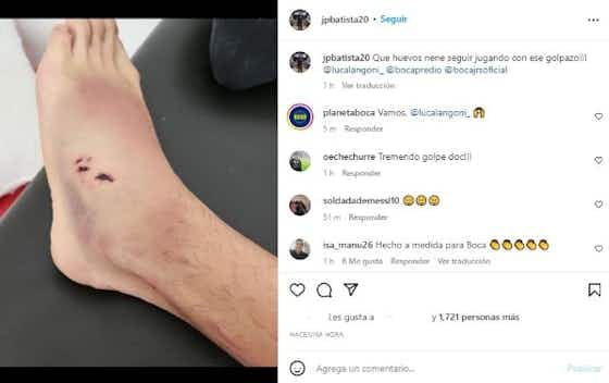 Imagen del artículo:La impresionable foto del tobillo lesionado de Langoni