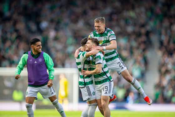 Article image:James Forrest may be the man who can make it happen for Celtic