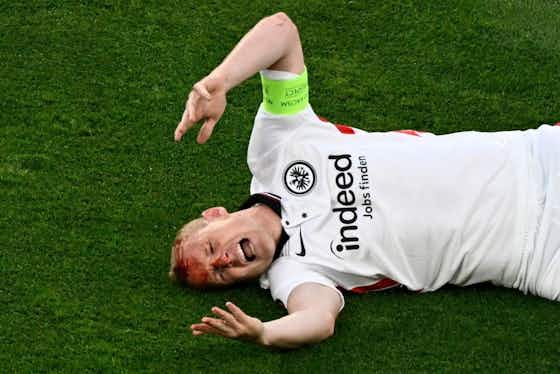 Article image:📸 Ouch! Sebastian Rode receives nasty cut early in EL final 🤕