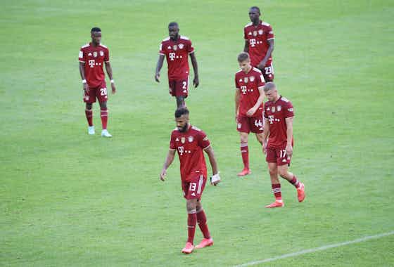 Article image:Julian Nagelsmann critical yet hopeful after Bayern lose to Gladbach