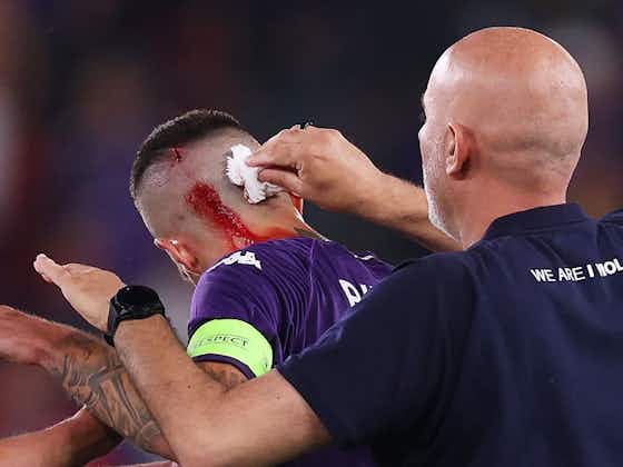 Immagine dell'articolo:😡 Biraghi colpito alla testa, la Fiorentina non ci sta: “Episodio che ha condizionato la gara”