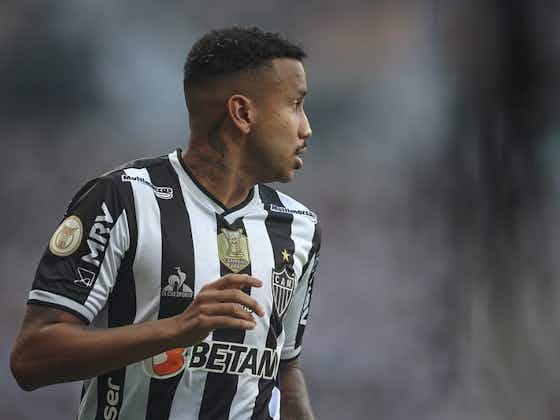 Imagem do artigo:Atlético Mineiro atualiza situação de Jair após cirurgia na mão e fala sobre período de recuperação