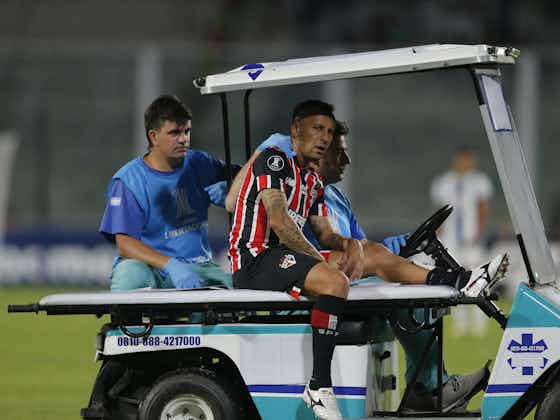 Imagem do artigo:Carpini se incomoda com incidência de lesões, e São Paulo se reúne com DM