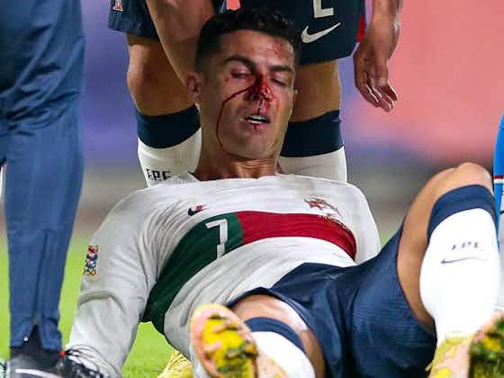 Image de l'article :République tchèque - Portugal : énorme choc entre Ronaldo et le gardien, CR7 en sang (vidéo)