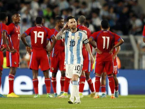 Image de l'article :Argentine, PSG : genou en sang, Messi a eu chaud après un tacle terrible