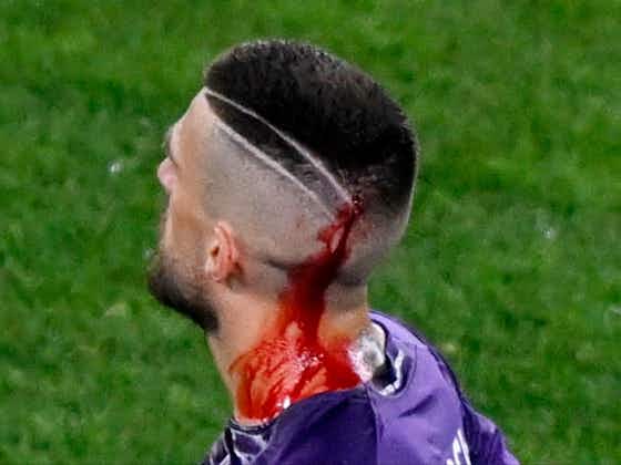 Article image:Fiorentina captain Cristiano Biraghi speaks out after being left bloodied by West Ham fan missiles