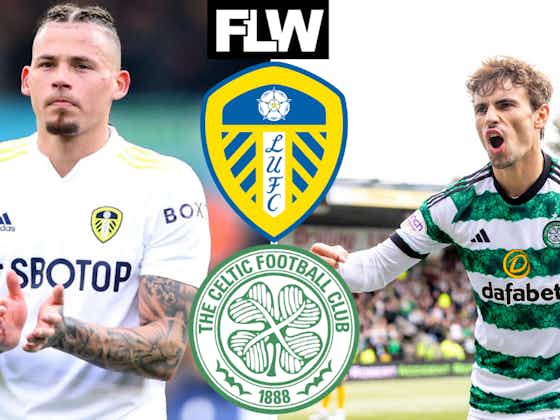 Article image:Leeds United must veer towards Celtic deal over Man City transfer: View