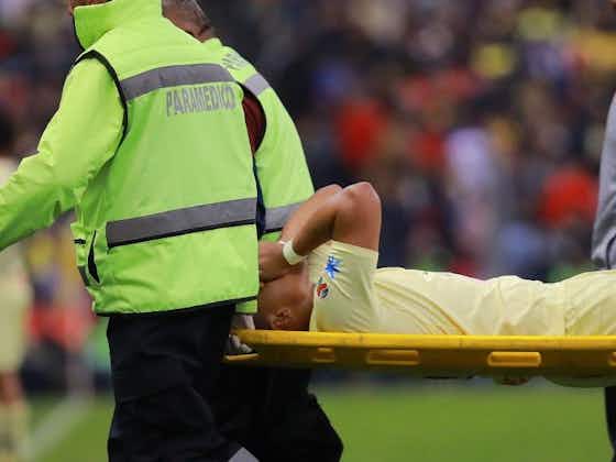 Article image:Club América dealt double injury blow before Apertura second leg