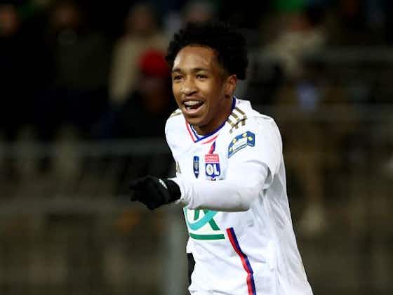 Imagen del artículo:Malick Fofana cree que le falta mayor experiencia para triunfar en el Olympique Lyon