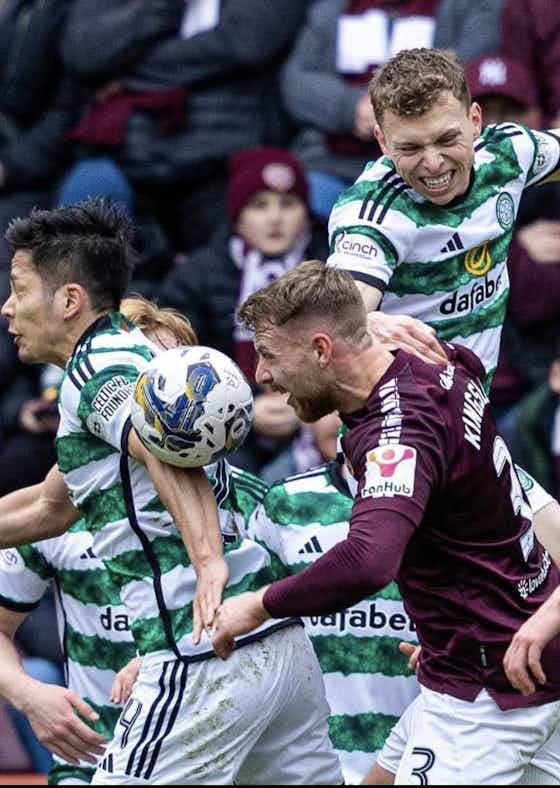 Article image:Celtic can be pleased as Rodgers escapes Ibrox ban but sits out Livingston