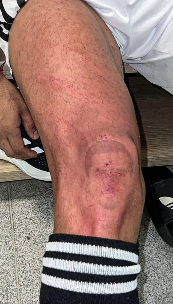 Imagen del artículo:Salvaje planchazo a Zaracho en Brasil: la herida en la rodilla que desató la bronca de Atlético Mineiro