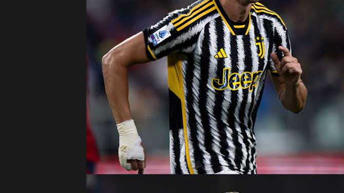 Imagem de visualização para Raio-X: Tudo sobre Juventus x Lazio