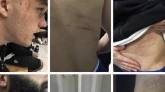 Vorschaubild für 🎥 Skandal in der Türkei: Spieler attackiert Gegner mit Rasierklinge