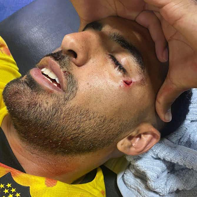 Anteprima immagine per 🎥 Shock in Argentina: ferito con una pietrata l'ex Fiorentina Olivera