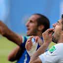Preview image for Suárez eat your heart out! German player bites off opponent's nose