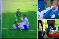 Preview image for Ben Godfrey: Everton star stretchered off vs Chelsea after nasty injury