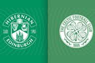 Preview image for Celtic’s Complicated Relationship With Hibernian – (Part 4)
